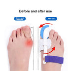 Adjustable Toe Alignment Support for Men &amp; Women