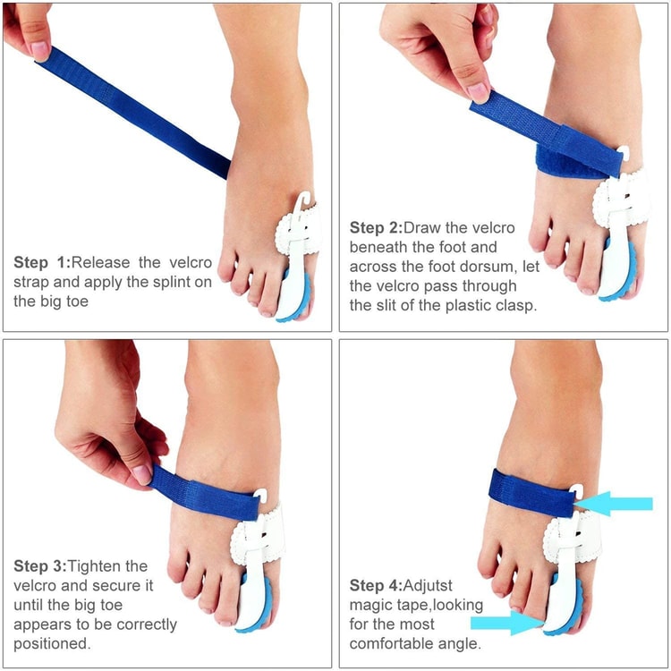 Adjustable Toe Alignment Support for Men &amp; Women